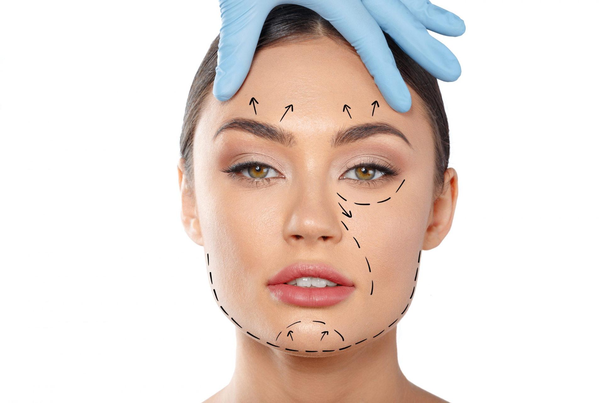 Harmonização Facial